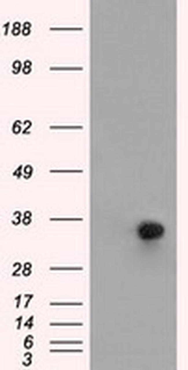 ERCC1 Antibody in Western Blot (WB)