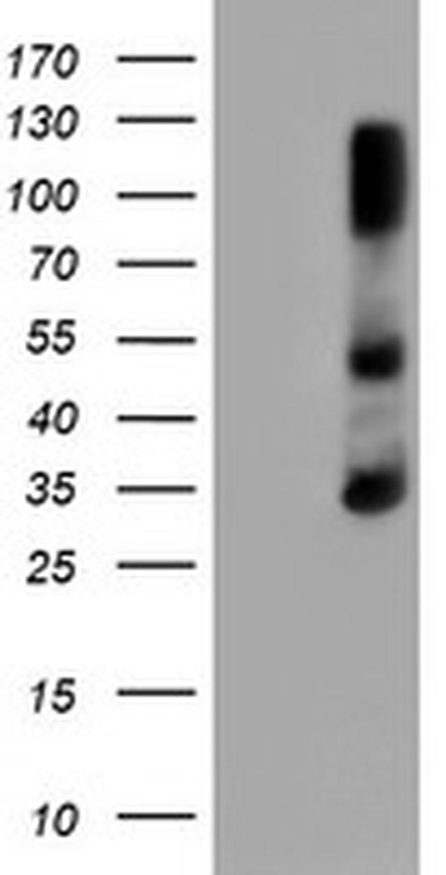 ERCC1 Antibody in Western Blot (WB)