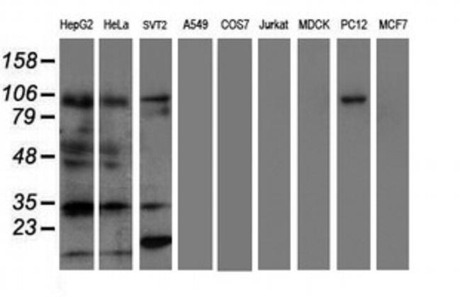 ERCC1 Antibody in Western Blot (WB)