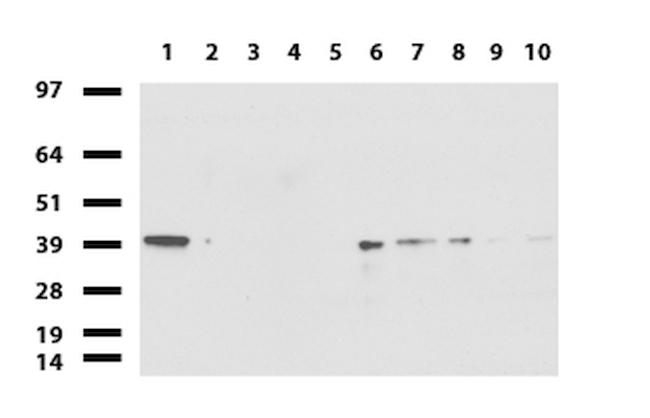 ERCC1 Antibody in Western Blot (WB)