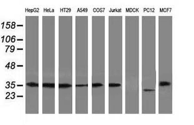 ERCC1 Antibody in Western Blot (WB)