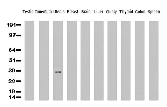 ERCC1 Antibody in Western Blot (WB)