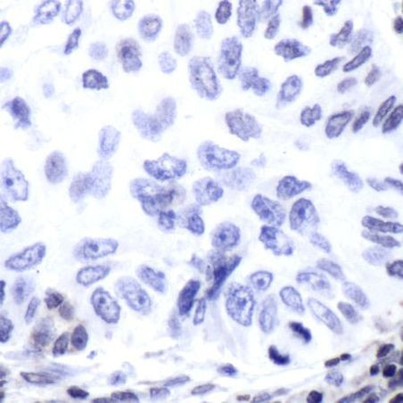 ERCC1 Antibody in Immunohistochemistry (Paraffin) (IHC (P))