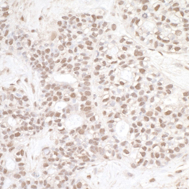 ERCC3 Antibody in Immunohistochemistry (IHC)