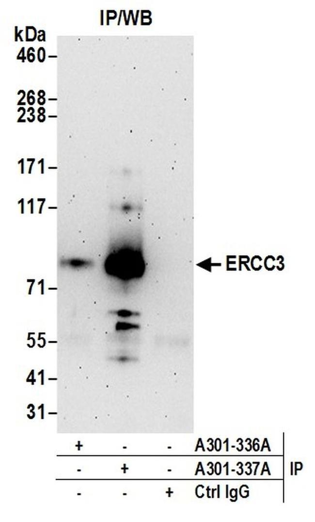 ERCC3 Antibody in Western Blot (WB)