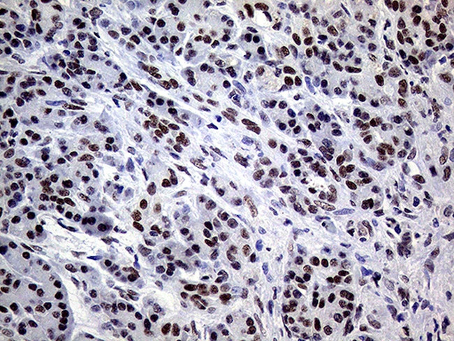 ERCC3 Antibody in Immunohistochemistry (Paraffin) (IHC (P))