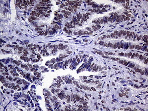 ERCC3 Antibody in Immunohistochemistry (Paraffin) (IHC (P))