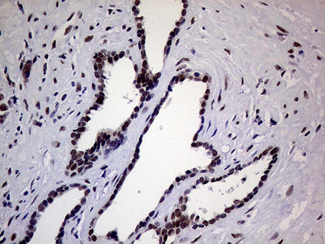 ERCC3 Antibody in Immunohistochemistry (Paraffin) (IHC (P))