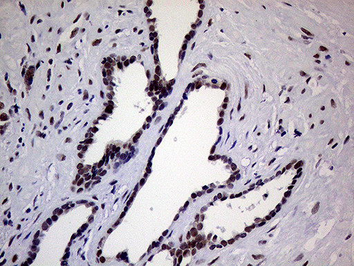 ERCC3 Antibody in Immunohistochemistry (Paraffin) (IHC (P))