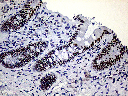 ERCC3 Antibody in Immunohistochemistry (Paraffin) (IHC (P))