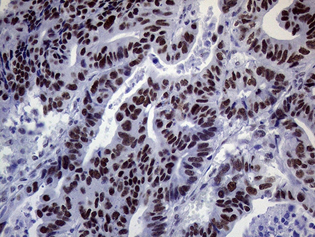 ERCC3 Antibody in Immunohistochemistry (Paraffin) (IHC (P))