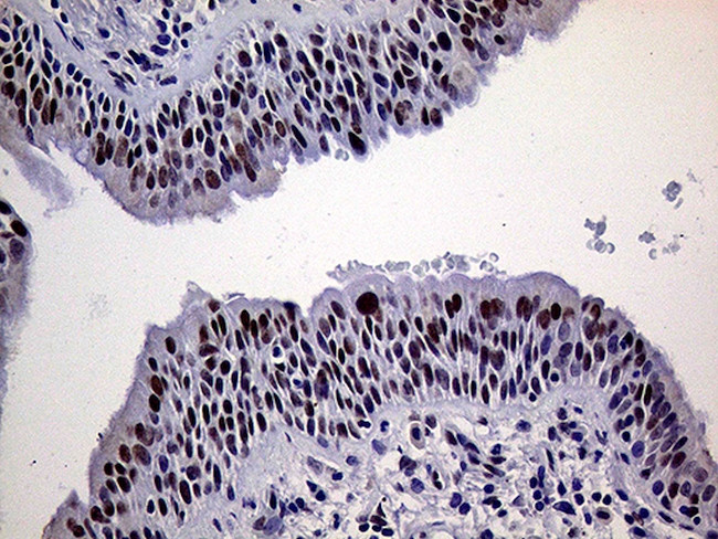 ERCC3 Antibody in Immunohistochemistry (Paraffin) (IHC (P))