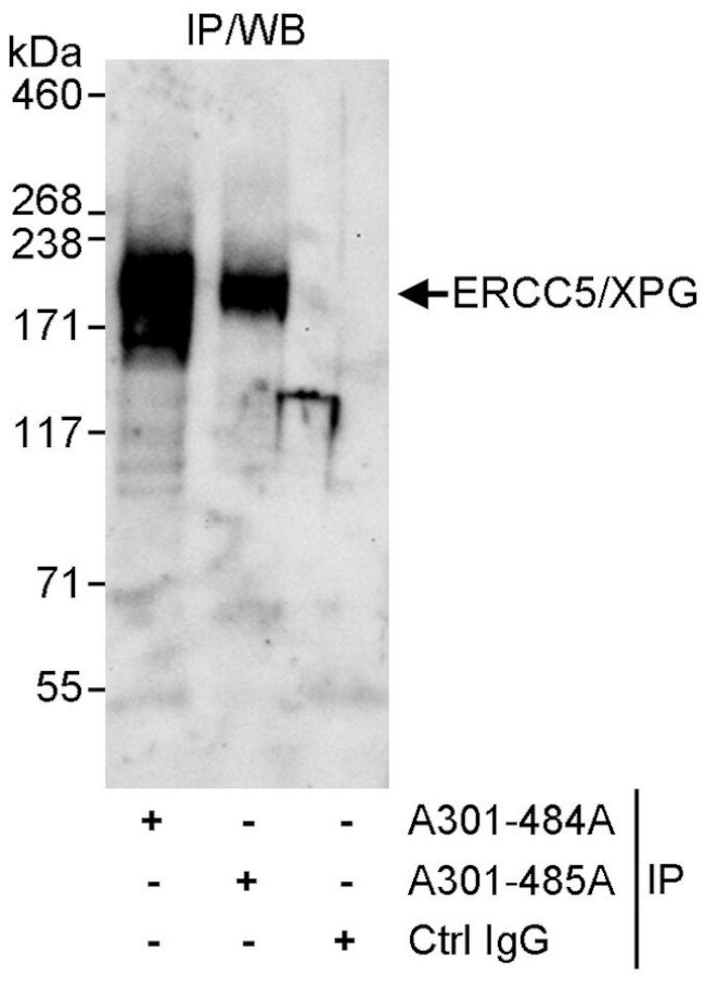 ERCC5/XPG Antibody in Immunoprecipitation (IP)