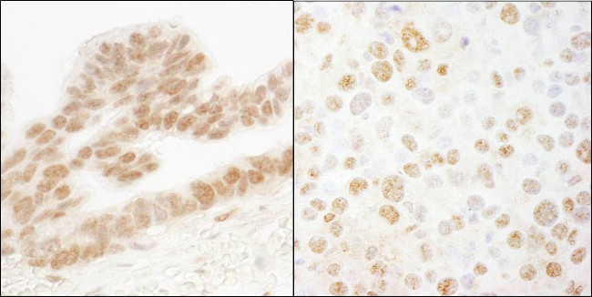 ERF Antibody in Immunohistochemistry (IHC)