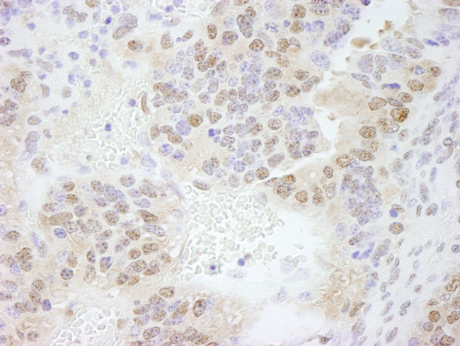 ERF Antibody in Immunohistochemistry (IHC)