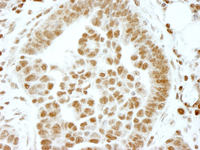 ERF Antibody in Immunohistochemistry (IHC)