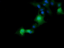 ERG Antibody in Immunocytochemistry (ICC/IF)