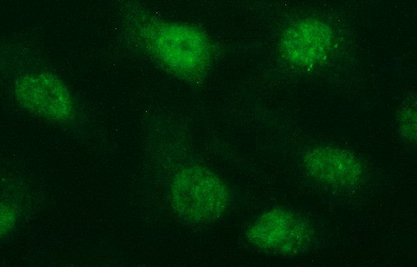 ERG Antibody in Immunocytochemistry (ICC/IF)