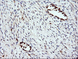 ERG Antibody in Immunohistochemistry (Paraffin) (IHC (P))