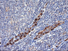 ERG Antibody in Immunohistochemistry (Paraffin) (IHC (P))