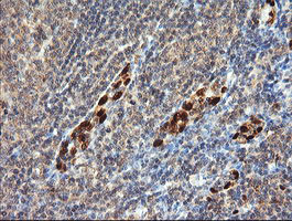 ERG Antibody in Immunohistochemistry (Paraffin) (IHC (P))