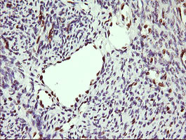 ERG Antibody in Immunohistochemistry (Paraffin) (IHC (P))