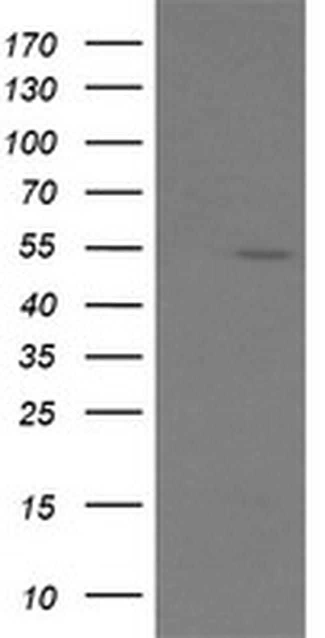 ERG Antibody in Western Blot (WB)