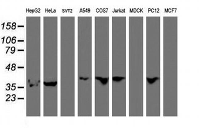 ERI1 Antibody in Western Blot (WB)