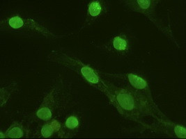 ERK3 Antibody in Immunocytochemistry (ICC/IF)