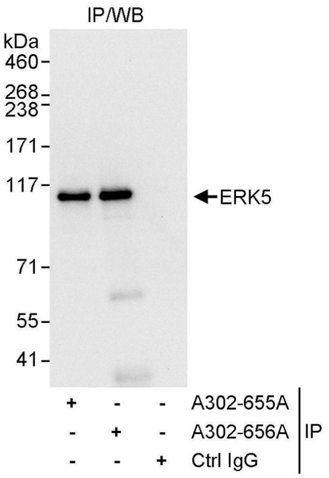 ERK5 Antibody in Immunoprecipitation (IP)