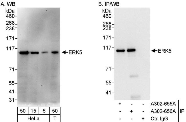 ERK5 Antibody in Western Blot (WB)