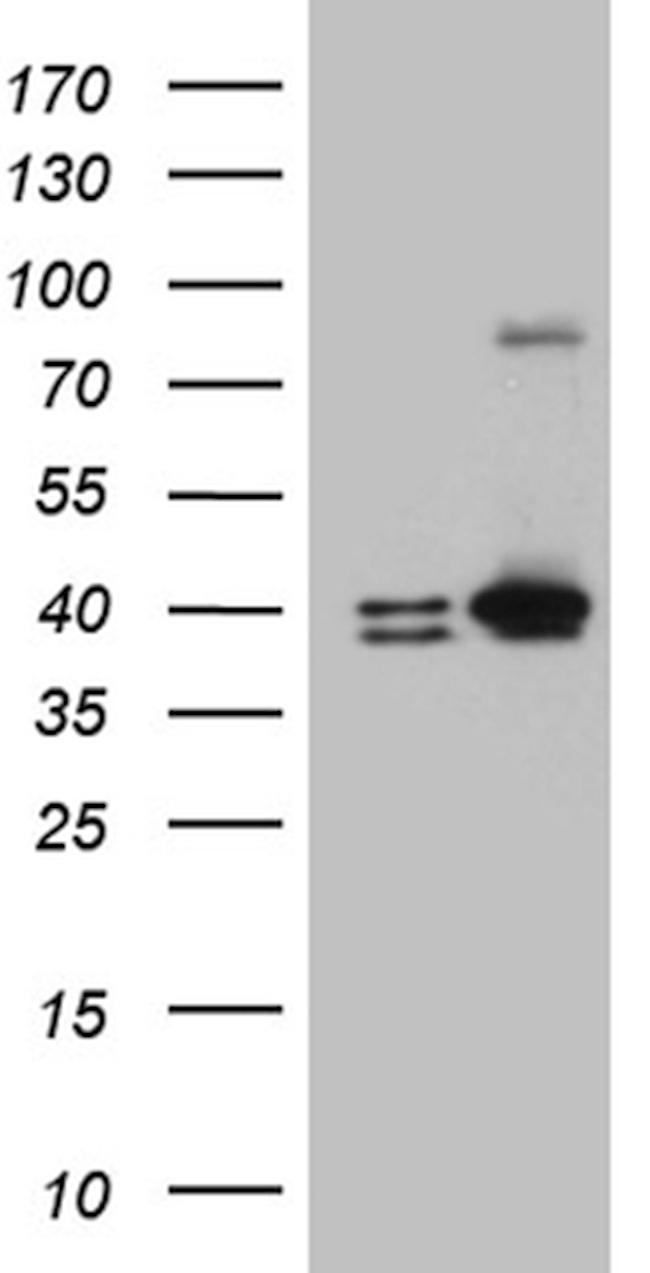 ERLIN1 Antibody in Western Blot (WB)