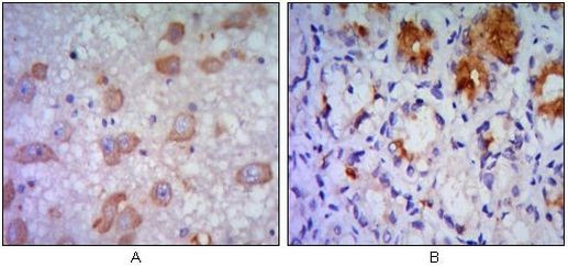 IRE1 alpha Antibody in Immunohistochemistry (Paraffin) (IHC (P))