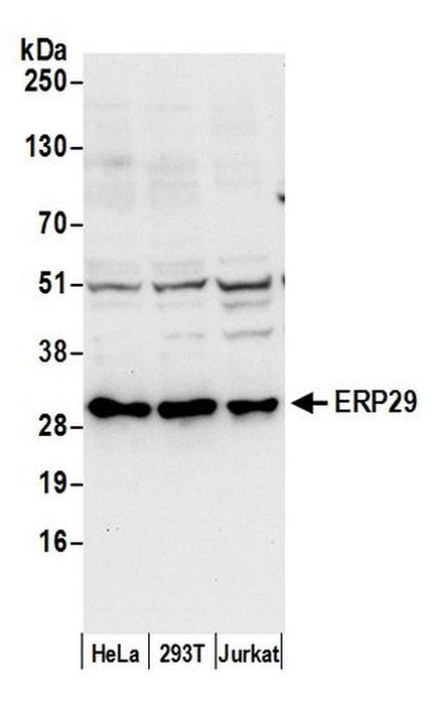 ERP29 Antibody in Western Blot (WB)