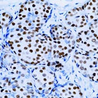 Estrogen Receptor alpha Antibody in Immunohistochemistry (Paraffin) (IHC (P))