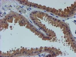 ESR1 Antibody in Immunohistochemistry (Paraffin) (IHC (P))