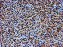 ESR1 Antibody in Immunohistochemistry (Paraffin) (IHC (P))