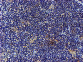 ESR1 Antibody in Immunohistochemistry (Paraffin) (IHC (P))