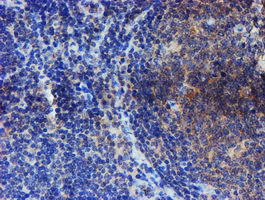 ESR1 Antibody in Immunohistochemistry (Paraffin) (IHC (P))