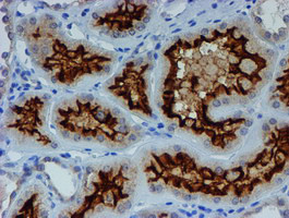 ESR1 Antibody in Immunohistochemistry (Paraffin) (IHC (P))