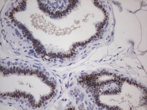 ESR1 Antibody in Immunohistochemistry (Paraffin) (IHC (P))