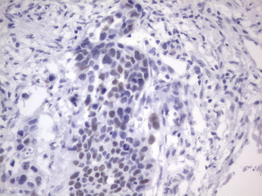 ESR1 Antibody in Immunohistochemistry (Paraffin) (IHC (P))