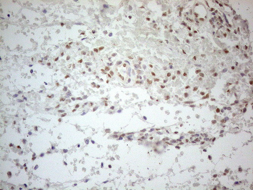 ESR1 Antibody in Immunohistochemistry (Paraffin) (IHC (P))