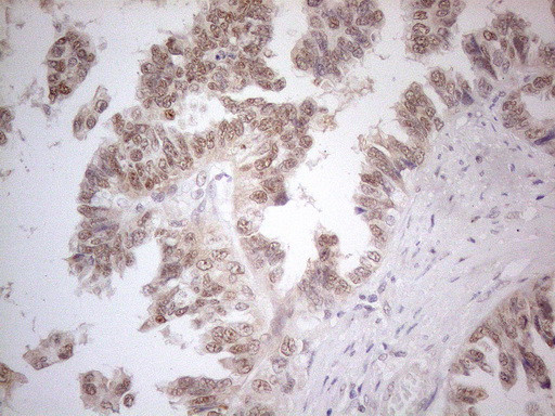 ESR1 Antibody in Immunohistochemistry (Paraffin) (IHC (P))