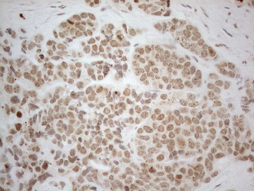 ESR1 Antibody in Immunohistochemistry (Paraffin) (IHC (P))