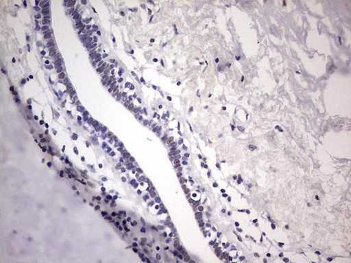 ESR1 Antibody in Immunohistochemistry (Paraffin) (IHC (P))