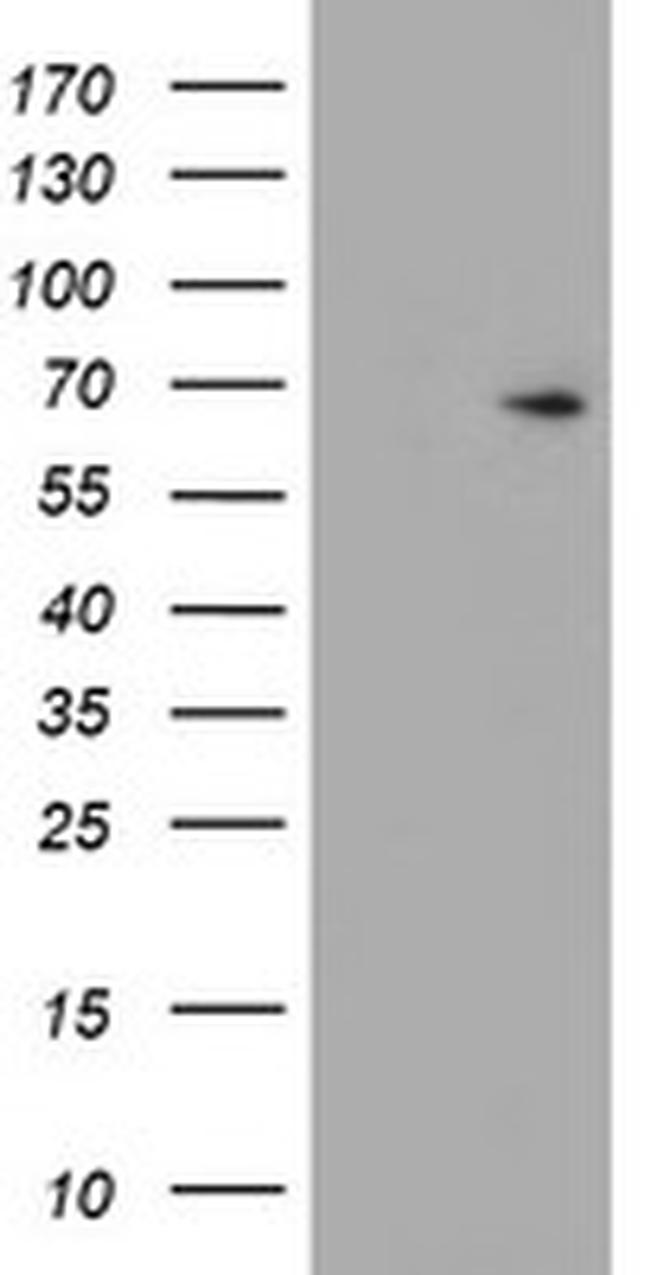 ESR1 Antibody in Western Blot (WB)