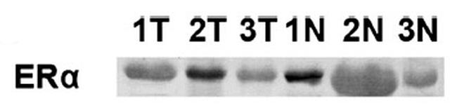 ESR1 Antibody in Western Blot (WB)