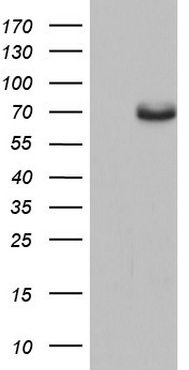 ESR1 Antibody in Western Blot (WB)