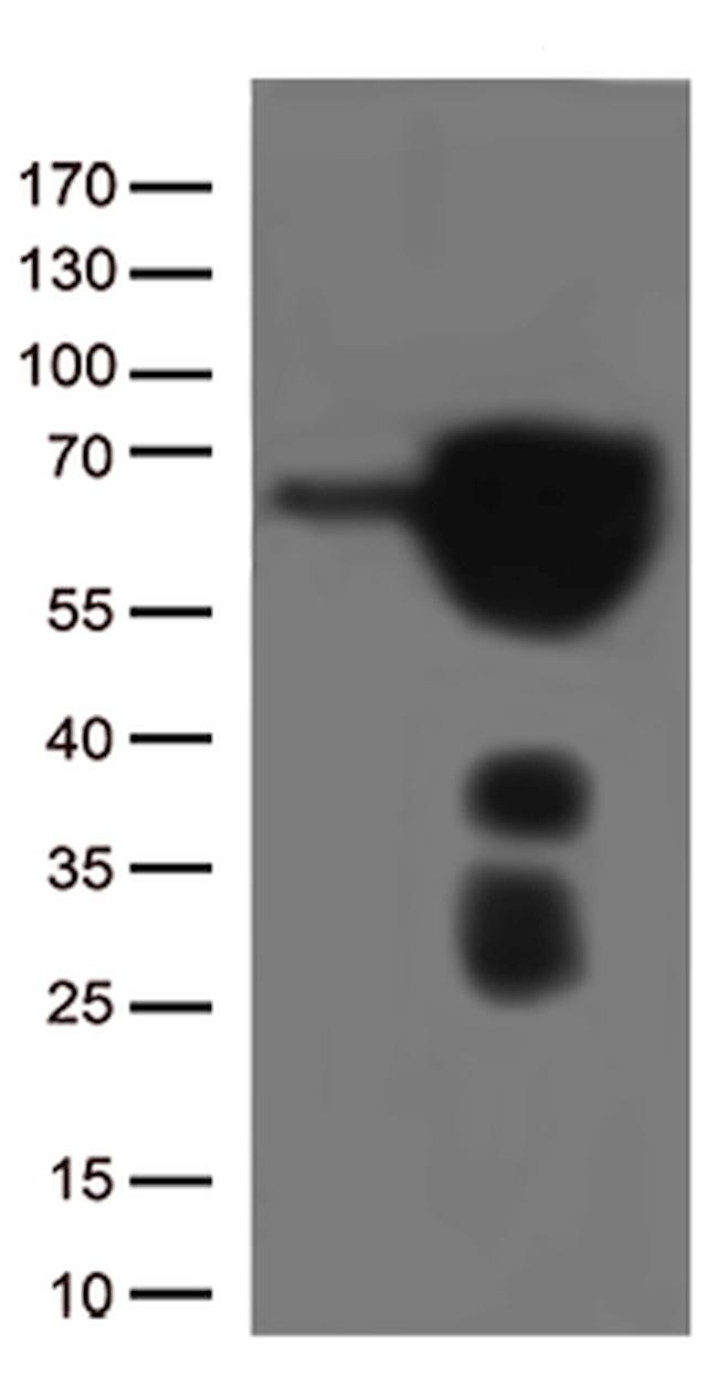 ESR1 Antibody in Western Blot (WB)